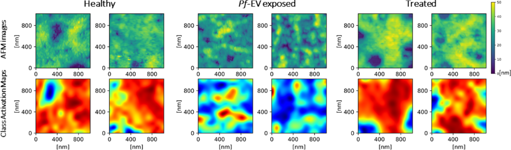 BJNANO - The role of convolutional neural networks in scanning probe ...